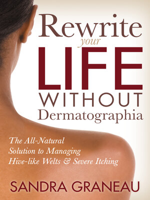 cover image of Rewrite Your Life Without Dermatographia